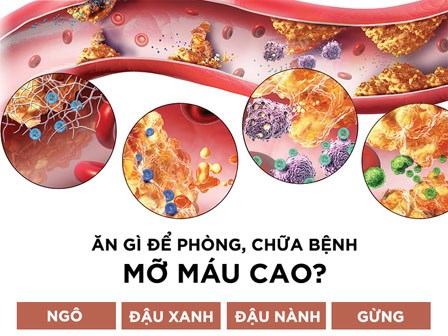 Mỡ máu cao gây ra 3 loại bệnh nguy hiểm, 