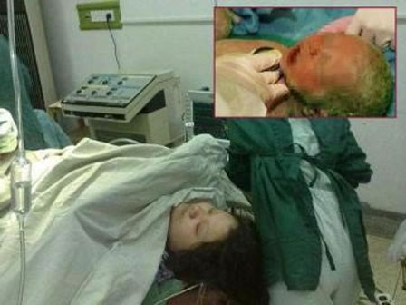 Bị ngứa nhưng bác sĩ cho thuốc không uống, bà mẹ hốt hoảng khi sinh ra con 
