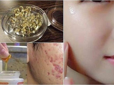 Là con gái nhất định phải biết hết những công dụng làm đẹp này của vitamin E