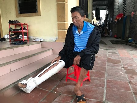 Con trai đánh bố gãy xương, bầm tím khắp người: 