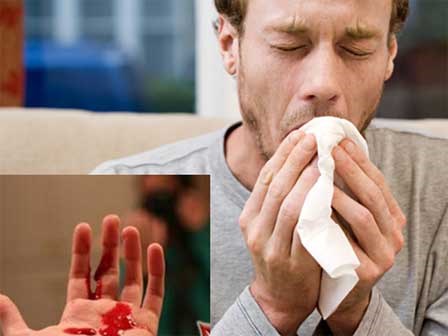 3 dấu hiệu của ung thư phổi: Chuyên gia nhắc dù chỉ 1 dấu hiệu nhỏ cũng không nên bỏ qua