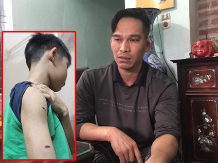 Bố đẻ bị tố đánh con dã man: 