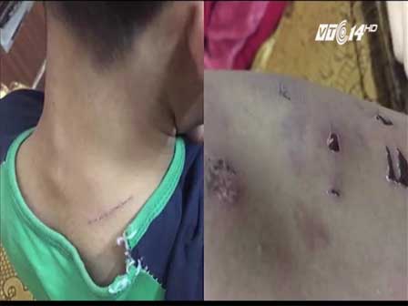 Phẫn nộ: Mẹ đánh con đến chảy máu rồi phát trực tiếp lên facebook-1