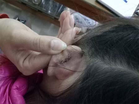 Công an vào cuộc vụ nam sinh cắn đứt tai bạn rồi nuốt luôn vào bụng-3