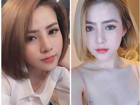 3 năm, 36 cuộc phẫu thuật thẩm mỹ, đây là câu chuyện làm đẹp HOT nhất những ngày qua!