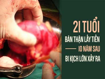 Bán thận vì không coi nó là gốc của sự sống, ai làm tốt 4 việc này thì thận mới