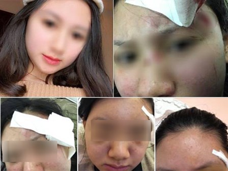 Người vợ xinh đẹp “tố” bị chồng đánh rách đầu, mang bầu cũng hành hung không tha