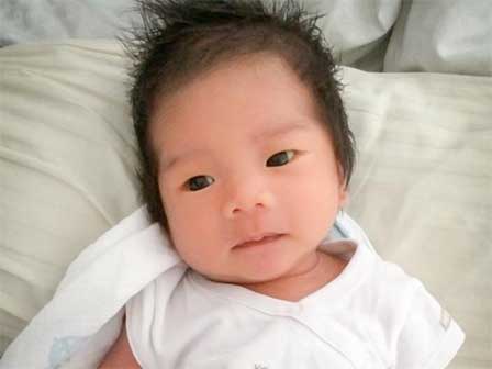 Bỏ quên vitamin K, nhiều cha mẹ đã phải ân hận khi con gặp di chứng-4