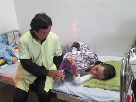 Nghẹn lòng tâm sự của người cha có con gái bị bỏng toàn thân do nướng mực