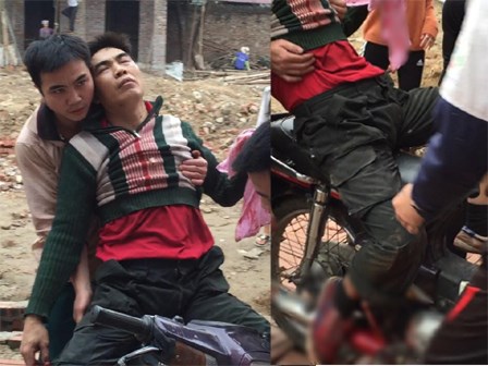 Người đàn ông bị nổ nát bàn tay khi nhặt vỏ đạn sau vụ nổ kinh hoàng ở Bắc Ninh