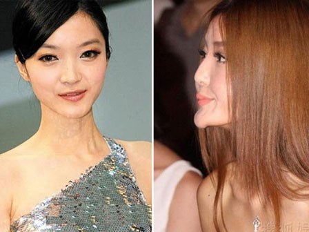 Quyết định gọt cằm, bạn rất có khả năng chịu một trong những biến chứng nguy hại khôn lường này!