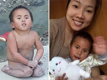 Bé gái trần truồng, ngồi lề đường trong giá rét được nhận nuôi và đưa đi chữa bệnh