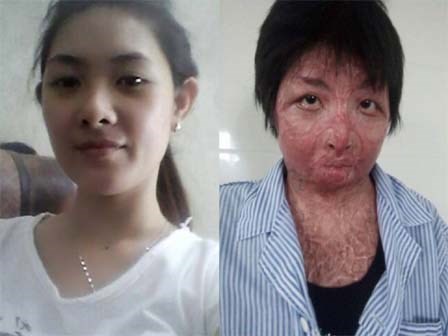 Cuộc sống tươi mới của người phụ nữ xinh đẹp bị chồng tẩm xăng đốt