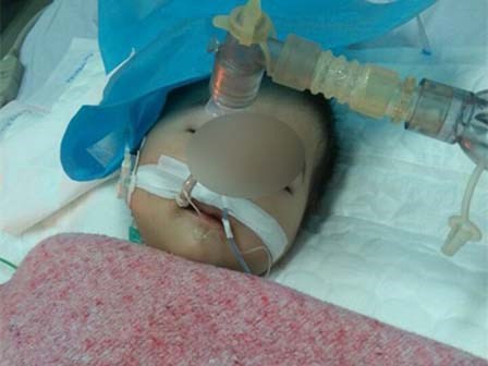 Xót xa bé 8 tháng tuổi bị tiêm nhầm thuốc: sức khỏe có cải thiện nhưng tiên lượng... rất dè dặt