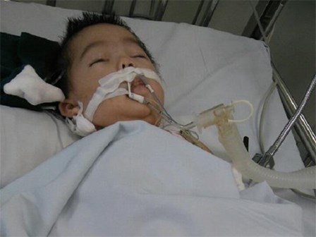 Vụ bé 8 tháng bị điều dưỡng tiêm nhầm thuốc: Cháu bé đang có dấu hiệu chết não