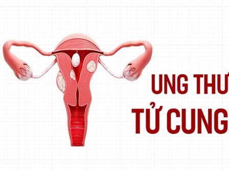 6 dấu hiệu sớm để nhận biết căn bệnh ung thư nguy hiểm: Hãy dành 6 phút để cứu một đời