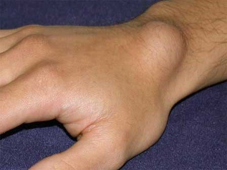 Khi xuất hiện 4 dấu hiệu này hãy coi chừng trong cơ thể bạn đã có tế bào ung thư