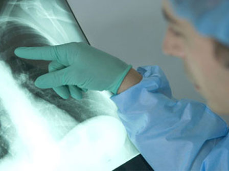 Con bị viêm phổi đưa đi khám, mẹ hoang mang khi bác sĩ quan tâm tới chiều cao của con-5