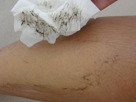 Tường tận các bước triệt lông vĩnh viễn tại nhà với oxy già ai ai cũng làm được!