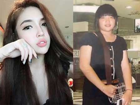 Sinh ra với ngoại hình kém xinh, cô gái dùng cả tuổi xuân chỉ để phẫu thuật thẩm mỹ