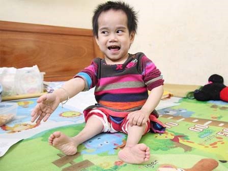 Cuộc sống mới của bé gái đi bằng
