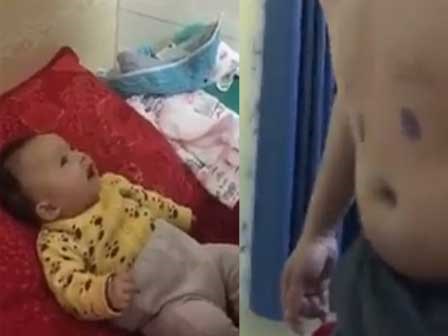 Bụng bia cũng thành