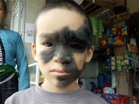 Cái Tết trọn vẹn đầu tiên của cậu bé 6 tuổi có khuôn mặt tựa