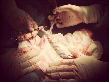 Hy hữu: Người dân giải cứu ông chú bỗng dưng mắc kẹt đầu vào bánh xe máy và ống pô-4