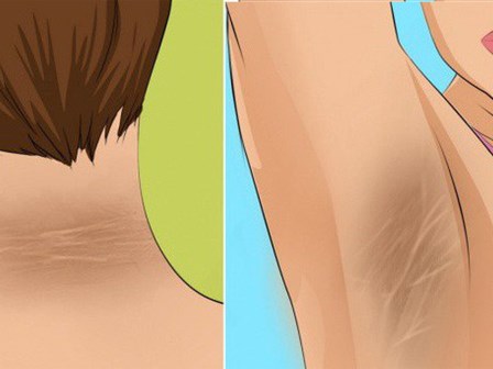 9 triệu chứng sớm của bệnh tiểu đường ai cũng phải biết để nhận ra kịp thời