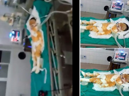 Chập điện cháy nhà giữa đêm, vợ chồng bỏng nặng, bé gái 4 tuổi nguy kịch