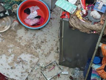 Người phụ nữ đi mua nhà bị lựu đạn nổ nát cả bàn tay-3