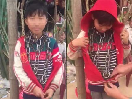 Phía sau câu chuyện bé trai bị chú ruột khóa xích sắt nhiều vòng trên cổ ở Thanh Hóa