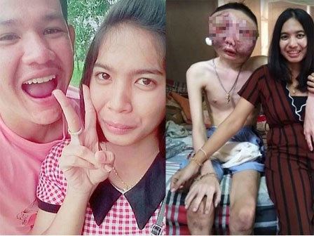 Vợ chăm sóc chồng ung thư với khuôn mặt biến dạng: 