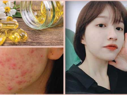 Bôi vitamin E lên mặt để dưỡng da, chị em nhận được kết quả hơn cả mong đợi!