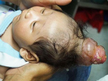 Kỳ lạ bé trai sinh ra đã có