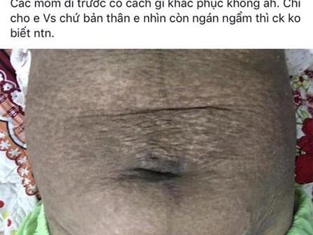 Sau sinh mẹ được gì? - Em bé như thiên thần và vùng bụng như thửa ruộng