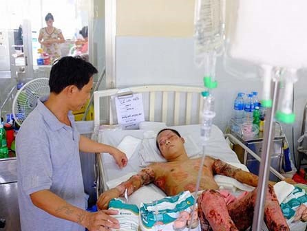 Thương cha không đủ sức khỏe, cậu bé 16 tuổi hai lần lóc da cứu anh ruột bị lửa dầu thiêu sống