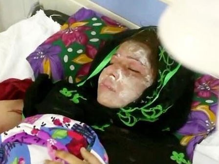 Muốn có con trai nối dõi nhưng vợ sinh toàn con gái, chồng nhẫn tâm đổ axit lên mặt vợ