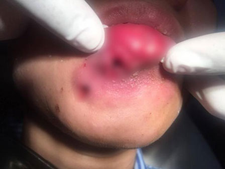 Những con thiêu thân nghiện dao kéo đến tàn tạ nhan sắc: Đừng mù quáng như họ!-18