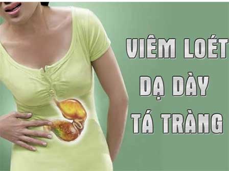 Ăn sữa chua theo cách này, viêm loét dạ dày và nhiều bệnh nguy hiểm sẽ tan biến-2