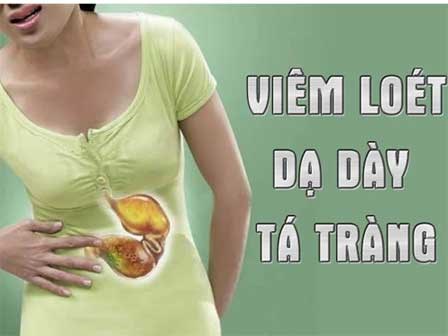 Những điều người bị viêm loét dạ dày tá tràng nhất định phải biết nếu muốn nhanh khỏi