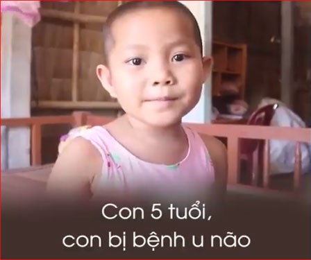 Bé gái 5 tuổi bị u não: 
