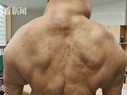 Nếu bỗng nhiên thấy sưng hoặc nổi cục ở cổ và tai, đừng bao giờ bỏ qua những khả năng này-7