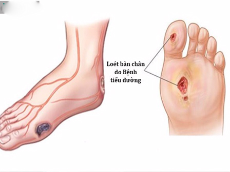 Không ăn tinh bột để giảm cân, giữ dáng: Trào lưu làm đẹp hay phá hoại nhan sắc, sức khoẻ?-6