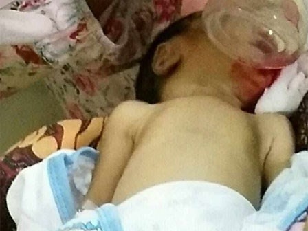 Tưởng cháu khóc vì đói, bà cho ăn cháo chuối khiến bé sơ sinh tử vong 1 giờ sau đó