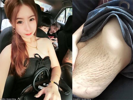 Đăng ảnh chiếc bụng rạn sau khi sinh bốn, người mẹ trẻ xinh đẹp bị dân mạng đổ lỗi ngược lại vì... sinh quá nhiều con!