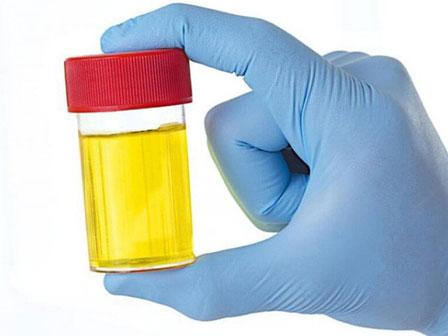 Ăn thức ăn để qua đêm, chàng trai bị suy thận cấp tính: 8 thực phẩm cấm kỵ ăn lại-11