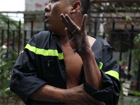 Nữ phóng viên chụp bức ảnh anh lính cứu hỏa bị bỏng tuột da tay: