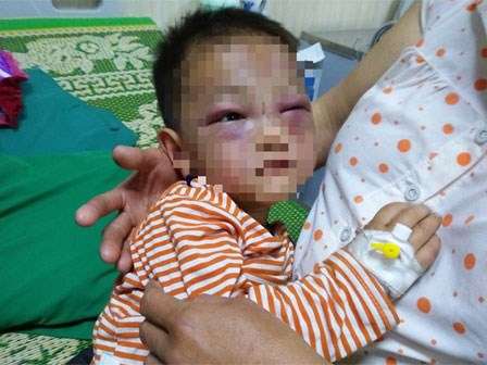 Xót cảnh bé trai 2 tuổi đẻ ra không biết mặt cha, đến khi mẹ lấy chồng thì bị cha dượng đánh đập phải nhập viện cấp cứu