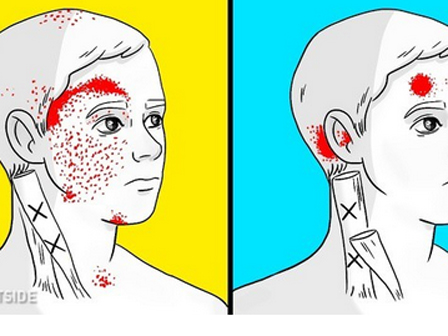 8 thực phẩm chữa đau nửa đầu hiệu quả hơn cả thuốc-9